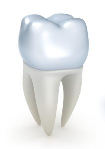  The Lifespan of Dental Crowns