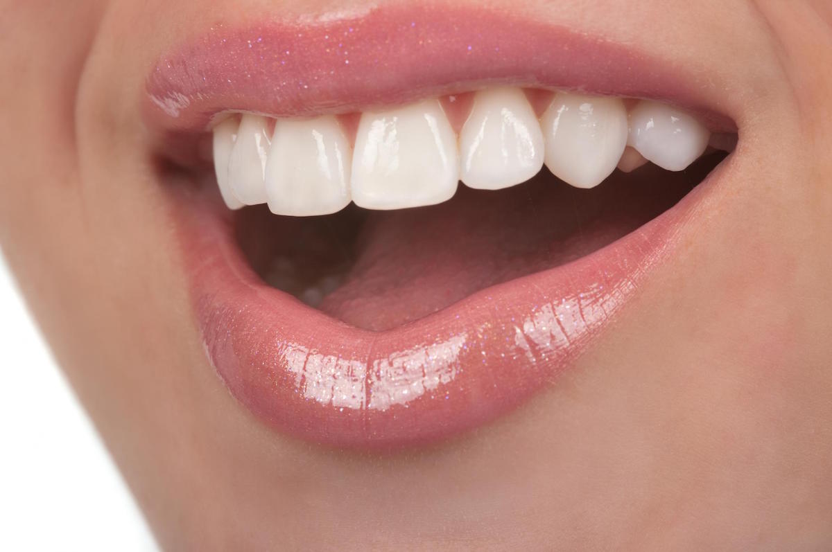 6 Ways to Get Healthier, Whiter Teeth