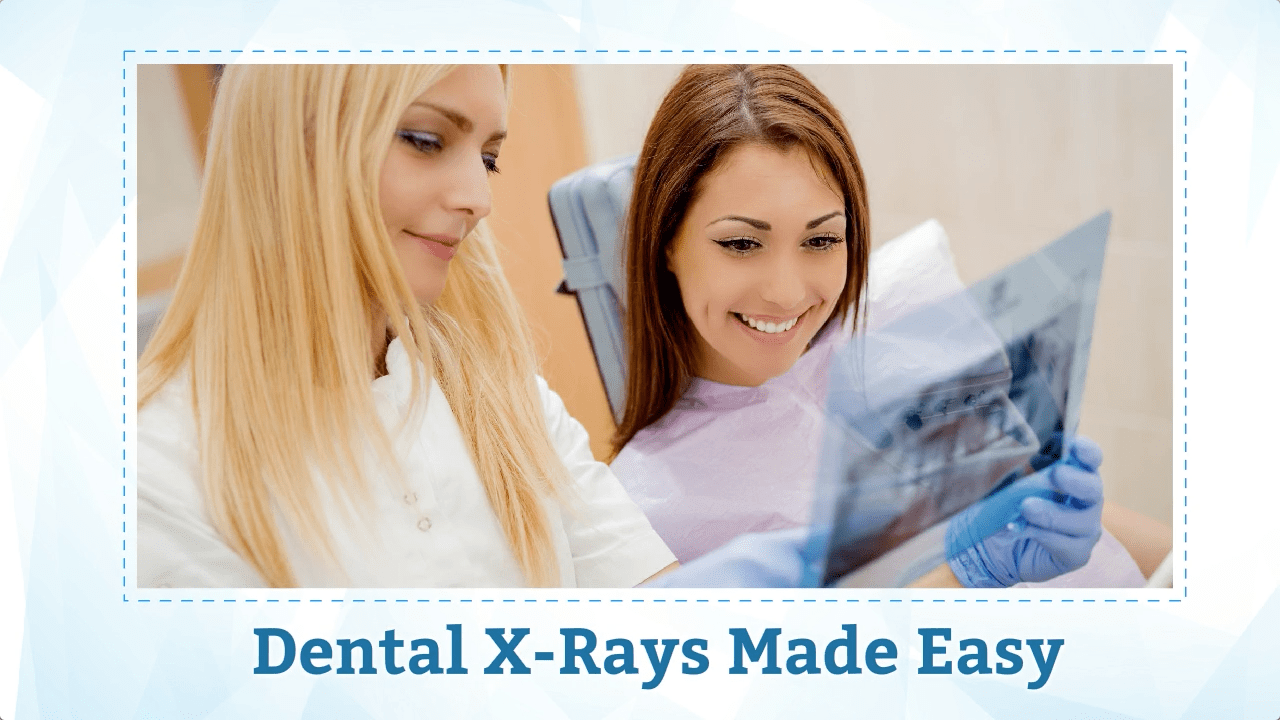 Dental X-rays: Everything You Need To Know About