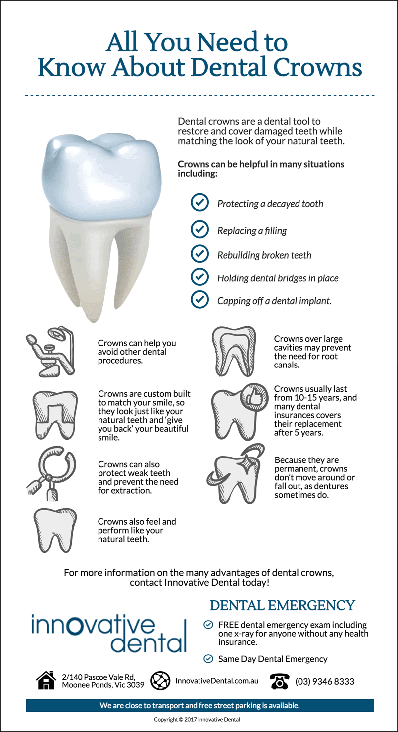 Important Things You Need to Know About Dental Crowns