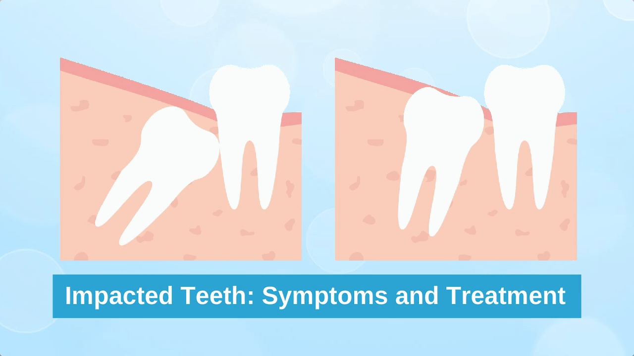Wisdom Tooth Problems: Signs and Treatment