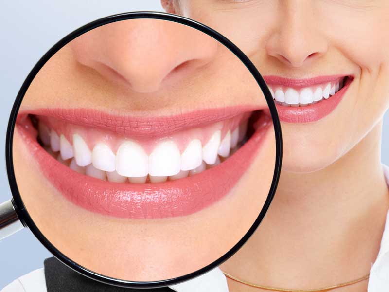The Questions You Ought to Ask About Whitening