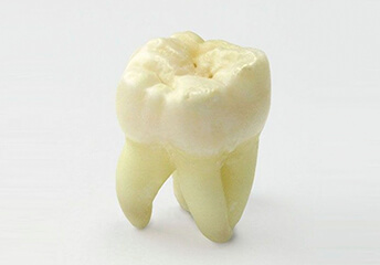 Teeth Whitening | Innovative Dental