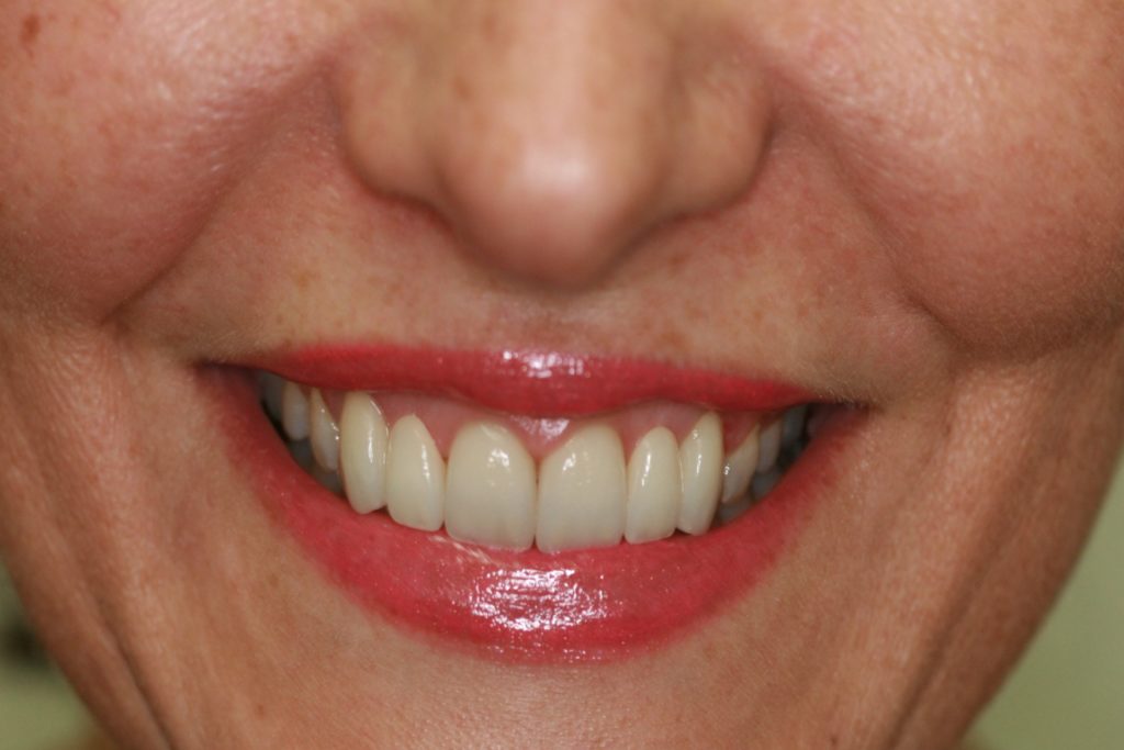 Woman with Healthy Teeth