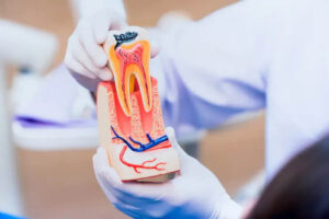 Dental Implant Melbourne | Innovative Dental