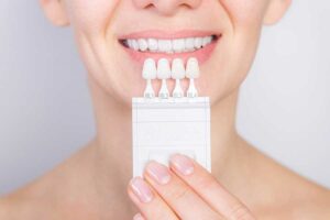 dental veneer treatment | cosmetic dentistry