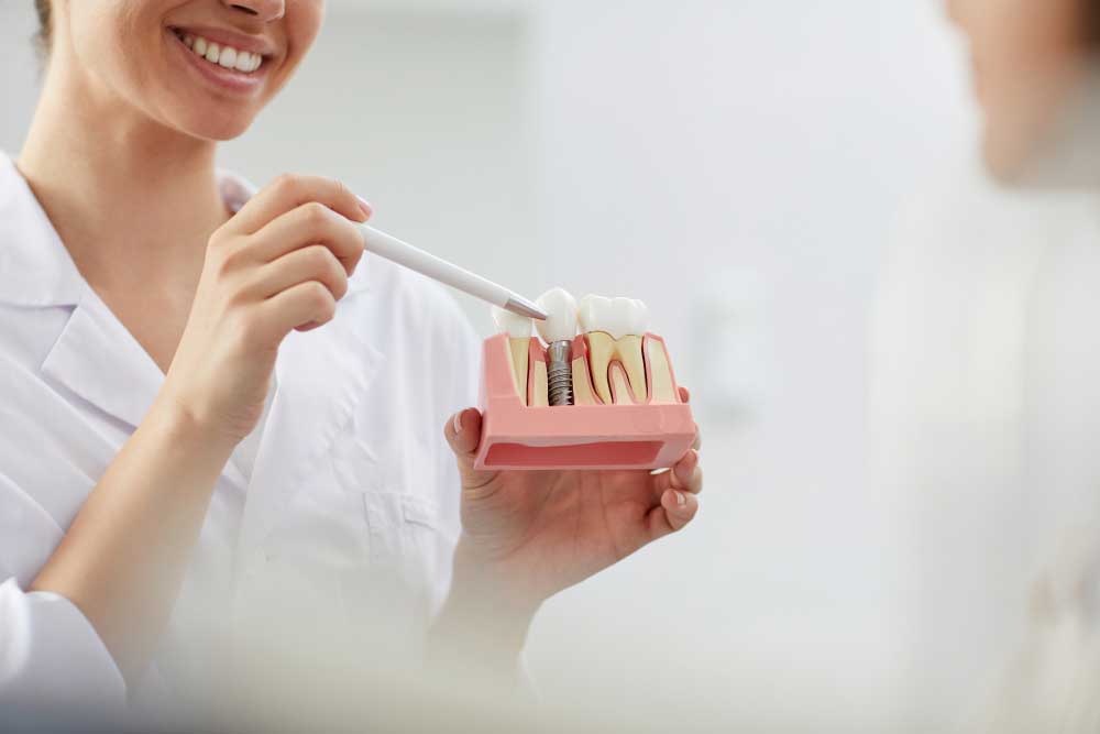 Different types of dental implants and advantages