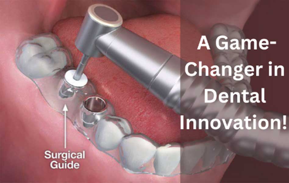 A Comprehensive Guide to Guided Implant Surgery