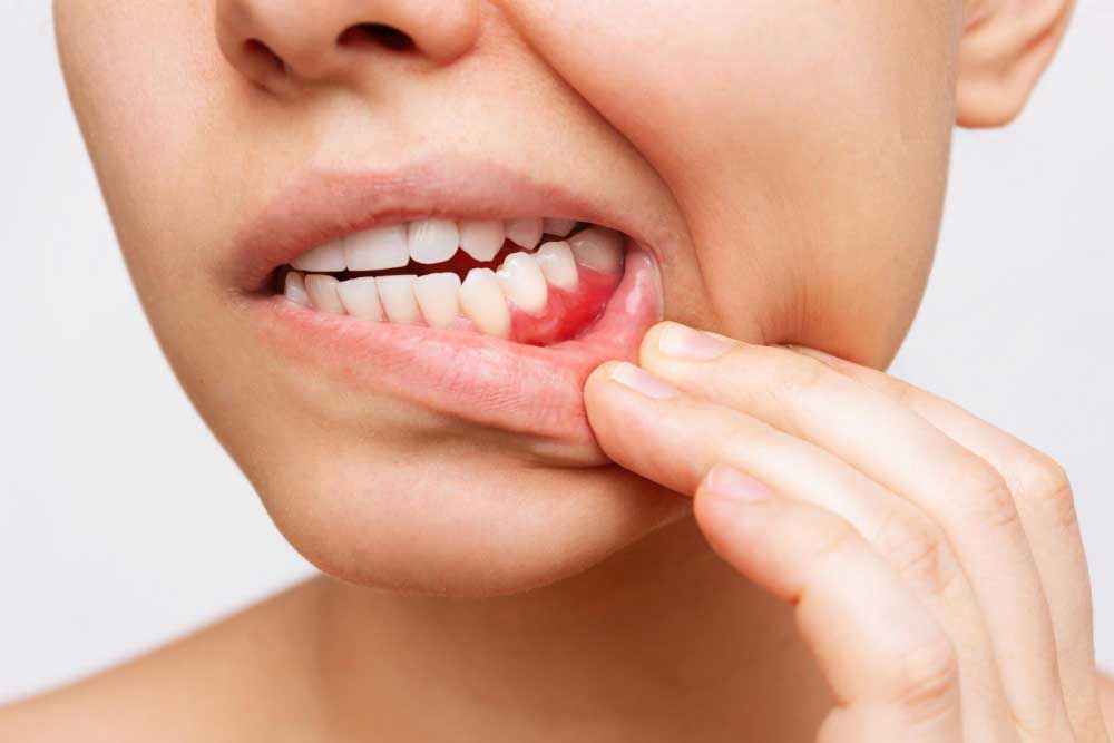 Gum Health Matters: Understanding Periodontal Disease and Prevention